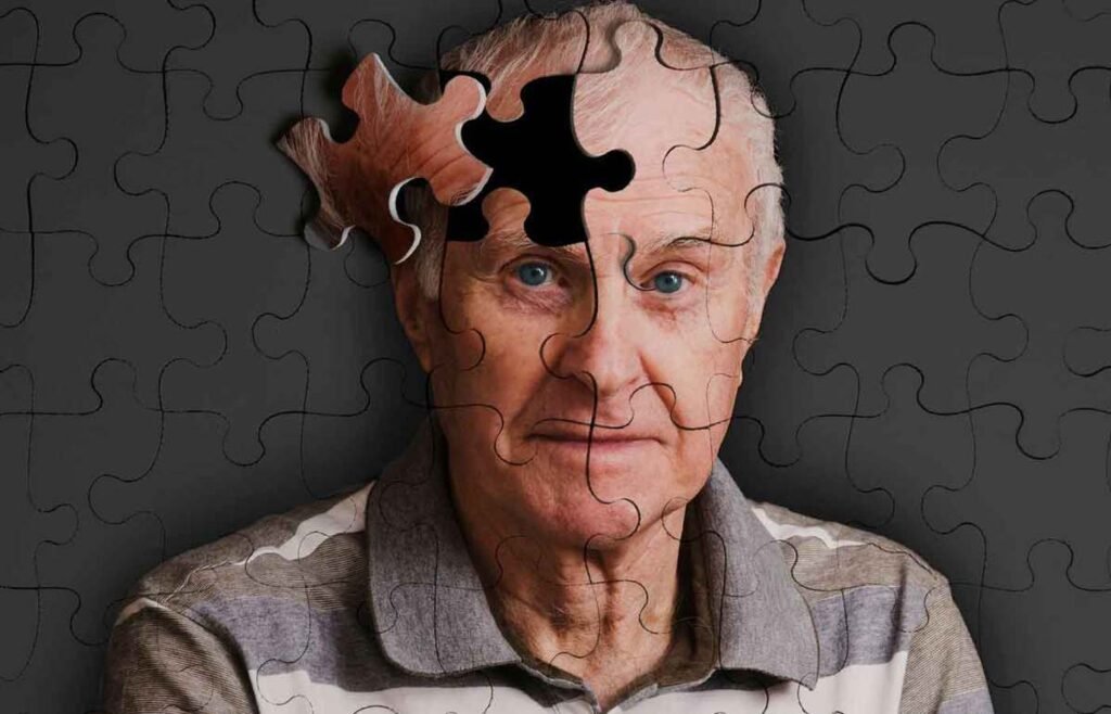Alzheimer Causes
