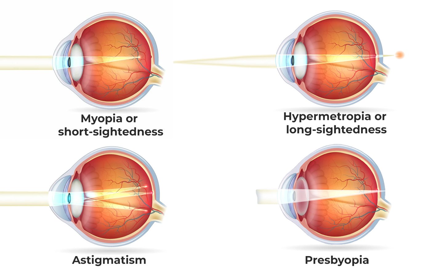 Human Eye: Structure, Working And Defects