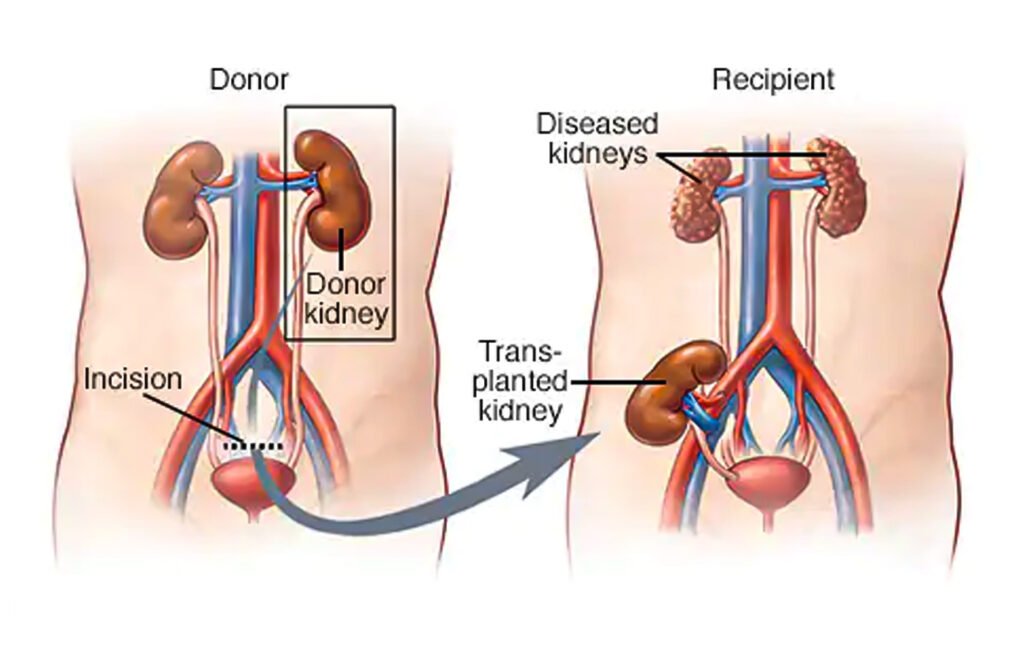kidney 4
